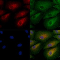Invitrogen JAKMIP2 Polyclonal Antibody 100 &mu;L; Unconjugated:Antibodies,