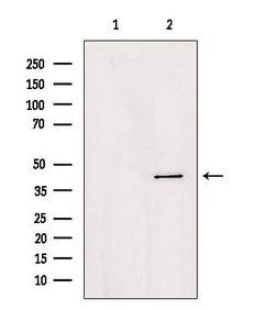 Invitrogen AGPAT4 Polyclonal Antibody 100 &mu;L; Unconjugated:Antibodies,