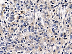 ADH7 Polyclonal Antibody:Antibodies, Polyclonal