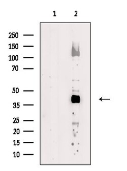 ADH7 Polyclonal Antibody:Antibodies, Polyclonal