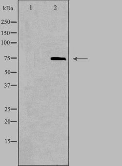 Invitrogen ABCD1 Polyclonal Antibody 100 &mu;L; Unconjugated:Antibodies,