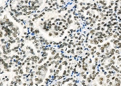 Invitrogen CA13 Polyclonal Antibody 100 &mu;L; Unconjugated:Antibodies,