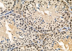 Invitrogen CA13 Polyclonal Antibody 100 &mu;L; Unconjugated:Antibodies,