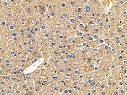 Invitrogen&trade;&nbsp;MICS1 Polyclonal Antibody