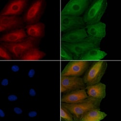 Invitrogen NKp30 Polyclonal Antibody 100 &mu;L; Unconjugated:Antibodies,