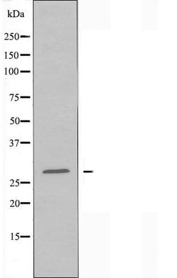 PEX11B Polyclonal Antibody 100 &mu;L | Buy Online | Thermo Scientific | Fisher Scientific