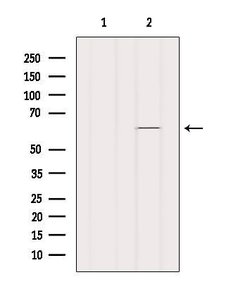 Invitrogen SLC30A1 Polyclonal Antibody 100 &mu;L | Buy Online | Invitrogen&trade; | Fisher Scientific