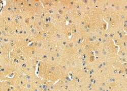 Invitrogen D4 Dopamine Receptor Polyclonal Antibody 100 &mu;L; Unconjugated:Antibodies,