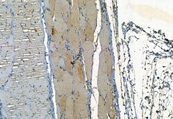 Invitrogen SMO Polyclonal Antibody 100 &mu;L; Unconjugated:Antibodies,