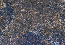 Invitrogen SMO Polyclonal Antibody 100 &mu;L; Unconjugated:Antibodies,