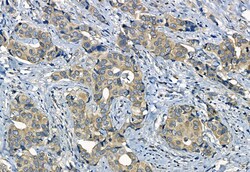 Invitrogen SMO Polyclonal Antibody 100 &mu;L; Unconjugated:Antibodies,