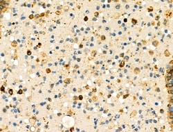 Invitrogen HLA-DRA Polyclonal Antibody 100 &mu;L; Unconjugated:Antibodies,