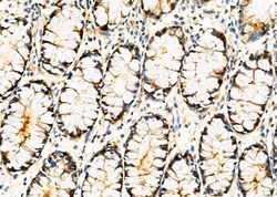Invitrogen XPB Polyclonal Antibody 100 &mu;L; Unconjugated:Antibodies,