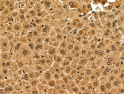 Invitrogen ABCG8 Polyclonal Antibody 100 &mu;L; Unconjugated:Antibodies,