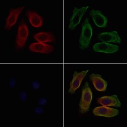 Invitrogen Urotensin II Receptor Polyclonal Antibody 100 &mu;L; Unconjugated:Antikroppar