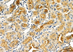 Invitrogen ABCA6 Polyclonal Antibody 100 &mu;L; Unconjugated:Antibodies,
