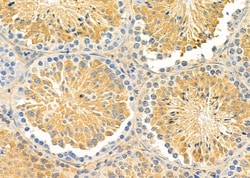 Invitrogen ABCA6 Polyclonal Antibody 100 &mu;L; Unconjugated:Antibodies,