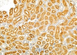 Invitrogen ABCA6 Polyclonal Antibody 100 &mu;L; Unconjugated:Antibodies,