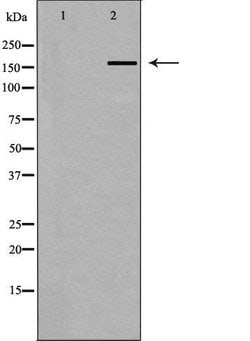Invitrogen ABCA6 Polyclonal Antibody 100 &mu;L; Unconjugated:Antibodies,