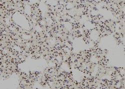 Invitrogen MSH3 Polyclonal Antibody 100 &mu;L; Unconjugated:Antibodies,