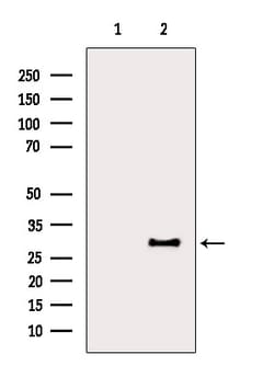 Invitrogen LAT Polyclonal Antibody 100 &mu;L; Unconjugated:Antibodies,