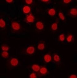 Invitrogen T-bet Polyclonal Antibody 100 &mu;L; Unconjugated:Antibodies,
