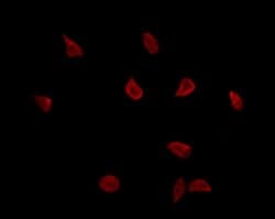 Invitrogen T-bet Polyclonal Antibody 100 &mu;L; Unconjugated:Antibodies,