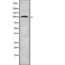 Invitrogen TNPO3 Polyclonal Antibody 100 &mu;L | Buy Online | Invitrogen&trade; | Fisher Scientific