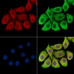 Invitrogen TRBC1 Polyclonal Antibody 100 &mu;L; Unconjugated:Antibodies,