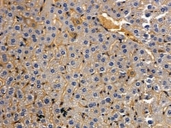 Invitrogen TRBC1 Polyclonal Antibody 100 &mu;L; Unconjugated:Antibodies,