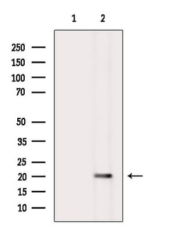 Invitrogen TRBC1 Polyclonal Antibody 100 &mu;L; Unconjugated:Antibodies,