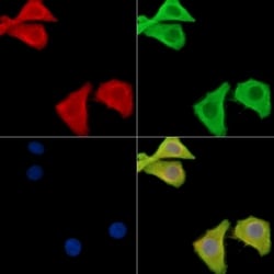 Invitrogen Galectin 4 Polyclonal Antibody 100 &mu;L | Buy Online | Invitrogen&trade; | Fisher Scientific