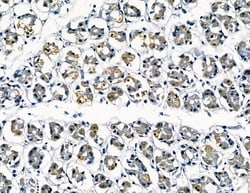 Invitrogen Galectin 4 Polyclonal Antibody 100 &mu;L | Buy Online | Invitrogen&trade; | Fisher Scientific