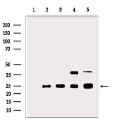 Invitrogen Galectin 4 Polyclonal Antibody 100 &mu;L | Buy Online | Invitrogen&trade; | Fisher Scientific