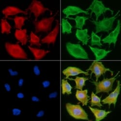 Invitrogen AATK Polyclonal Antibody 100 &mu;L; Unconjugated:Antibodies,