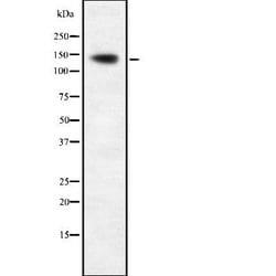 Invitrogen AATK Polyclonal Antibody 100 &mu;L; Unconjugated:Antibodies,
