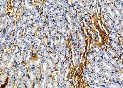 Invitrogen KRT81 Polyclonal Antibody 100 &mu;L; Unconjugated:Antibodies,