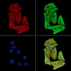Invitrogen ETNPPL Isoform 1 Polyclonal Antibody 100 &mu;L; Unconjugated:Antibodies,