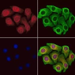 Invitrogen BCCIP Polyclonal Antibody 100 &mu;L; Unconjugated:Antibodies,