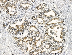 Invitrogen Claudin 9 Polyclonal Antibody 100 &mu;L; Unconjugated:Antibodies,