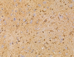 Invitrogen LRP12 Isoform A Precursor Polyclonal Antibody 100 &mu;L; Unconjugated:Antibodies,