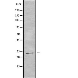 Invitrogen RAB19 Polyclonal Antibody 100 &mu;L; Unconjugated:Antibodies,