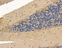 Invitrogen RhoGAP4 Polyclonal Antibody 100 &mu;L; Unconjugated:Antibodies,