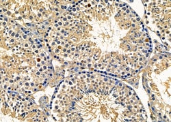 Invitrogen RhoGAP4 Polyclonal Antibody 100 &mu;L; Unconjugated:Antibodies,