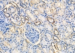 Invitrogen CCL27 Polyclonal Antibody 100 &mu;L; Unconjugated:Antibodies,