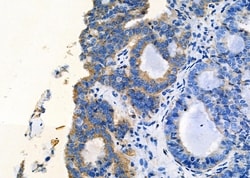 Invitrogen CCL27 Polyclonal Antibody 100 &mu;L; Unconjugated:Antibodies,