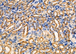 Invitrogen CCL27 Polyclonal Antibody 100 &mu;L; Unconjugated:Antibodies,