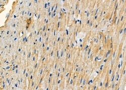 Invitrogen CCL27 Polyclonal Antibody 100 &mu;L; Unconjugated:Antibodies,