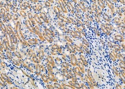 Invitrogen CCL27 Polyclonal Antibody 100 &mu;L; Unconjugated:Antibodies,