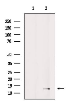Invitrogen CCL27 Polyclonal Antibody 100 &mu;L; Unconjugated:Antibodies,